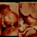 Mansfield Couple Could Use Community Support During Complicated Pregnancy with Twins